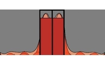 Enhancing the Lateral Resolution of White Light Optical Profilers Using AcuityXR Technology