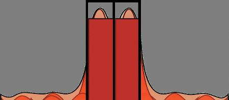 Illustration of pixel-limited resolution. The red bars represent the overall light collected in each pixel. The two adjacent features will not be distinguished because of inadequate camera pixel spacing.