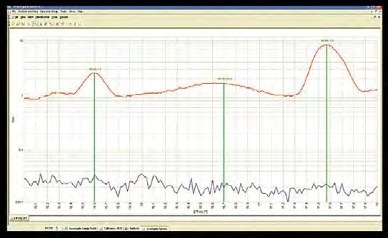 Removal of Rh tube lines with primary beam filter.