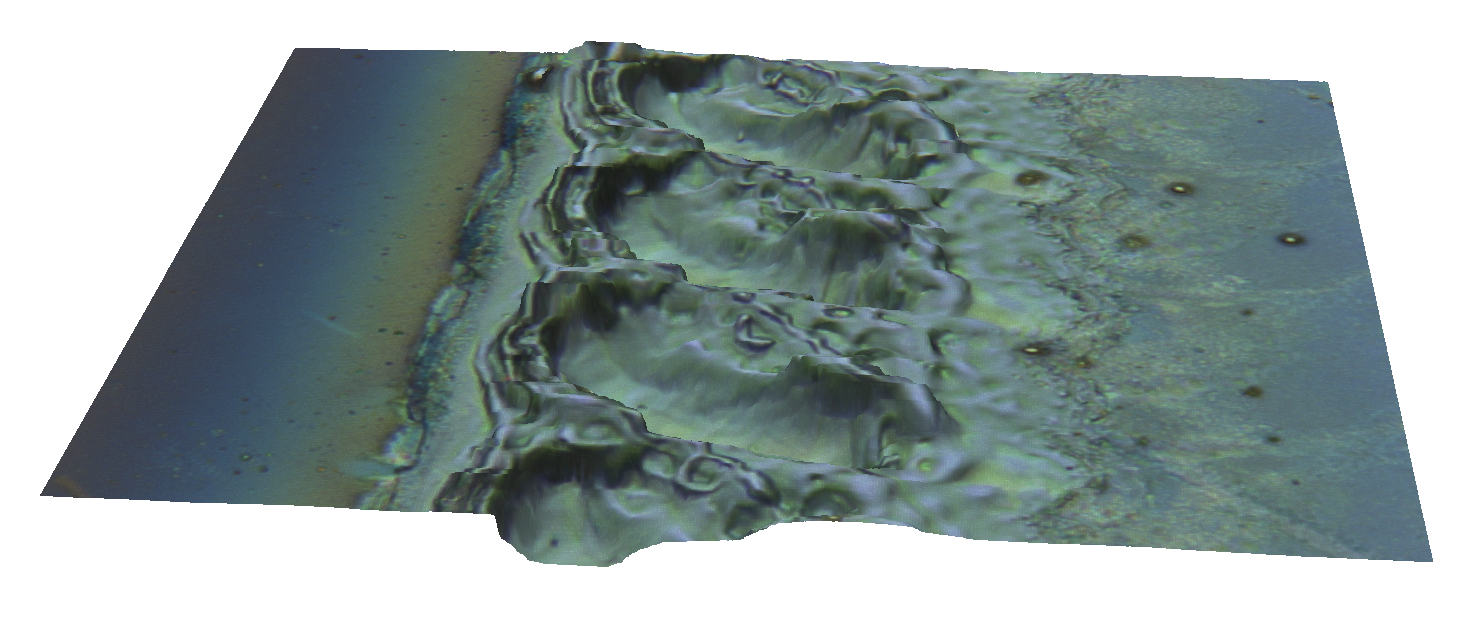 laser ablation