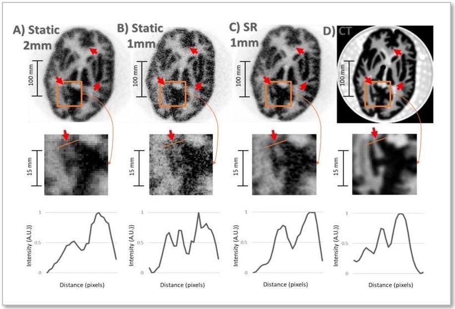 New Imaging Technique has Potential to Detect Neurological Disorders.