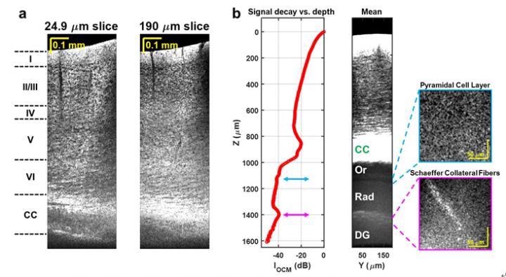 New Label-Free, Non-Invasive Optical Microscopy to Image Deep Inside the Brain.