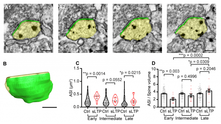 New Imaging Technique to Capture Single Spine Structural Plasticity.