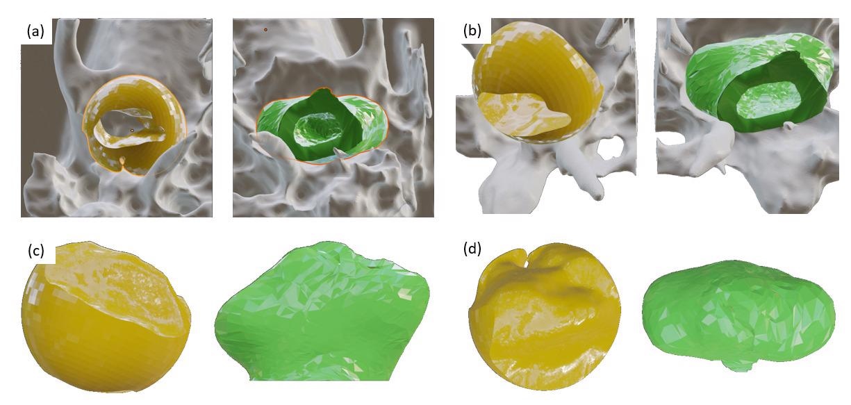 Rendered regions of the temporal bone, depicted in gray, with the temporomandibular joint negative volume shown in yellow (manually annotated) and green (machine-generated).