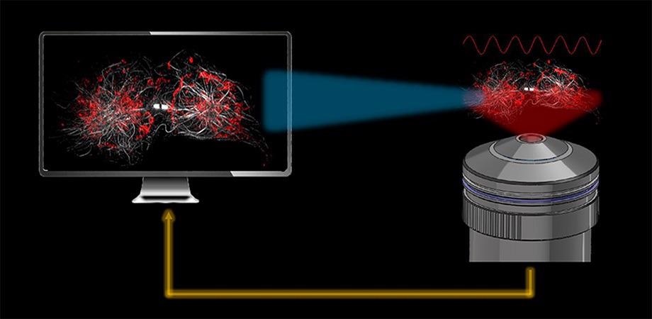 Novel Algorithm Delivers Superresolution Images Faster than the Current Standard Imaging Method.