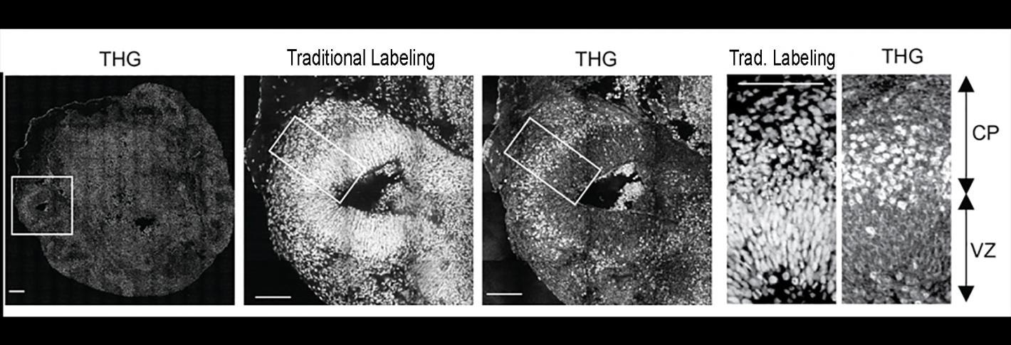 Imaging Technology Illustrates the Migration Path of Neurons in Rett Syndrome.