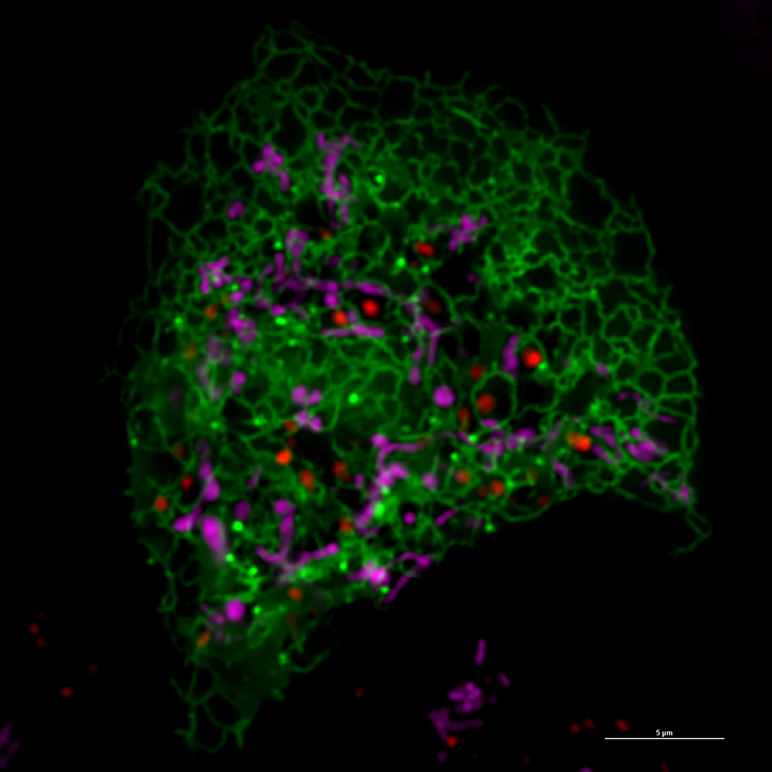 Researchers Discover Technique to Balance Mitochondria Naturally.