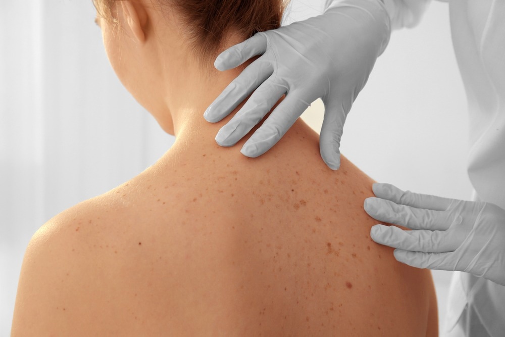skin cancer diagnosis, microscopic imaging, machine learning