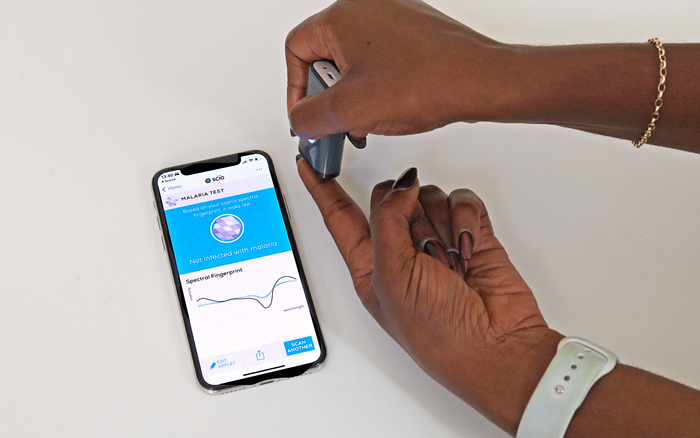 Revolutionary Malaria Detection Tool