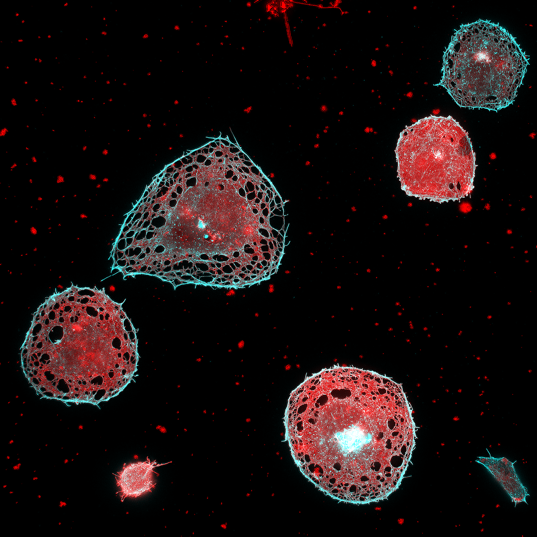 Developing Fast Super-Resolution Imaging with New Fluorescence Microscope