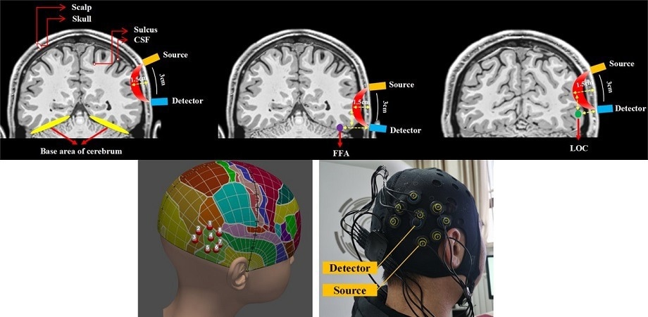 fNIRS Sheds Light on Brain Activity