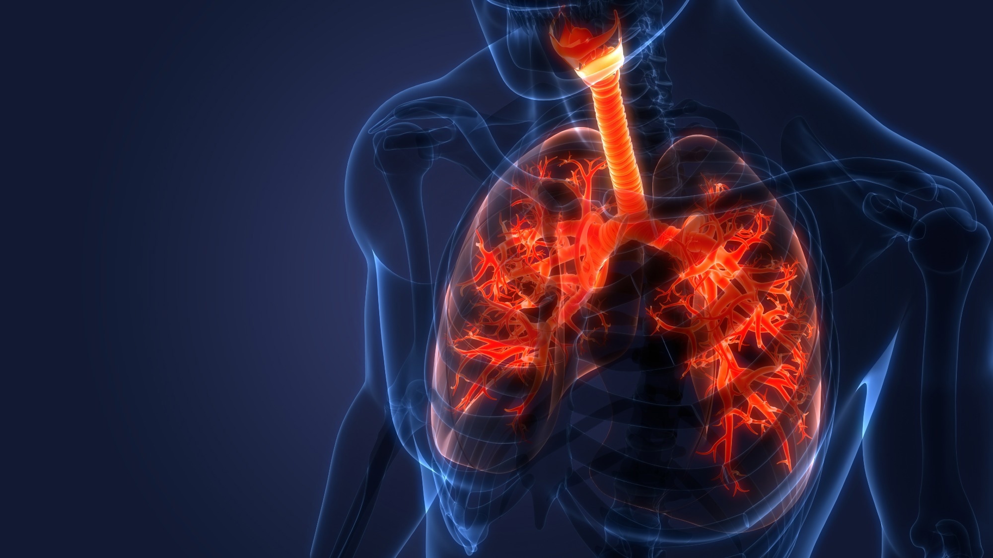 Real-Time Bacterial Detection in CF Patients Using APPI-MS