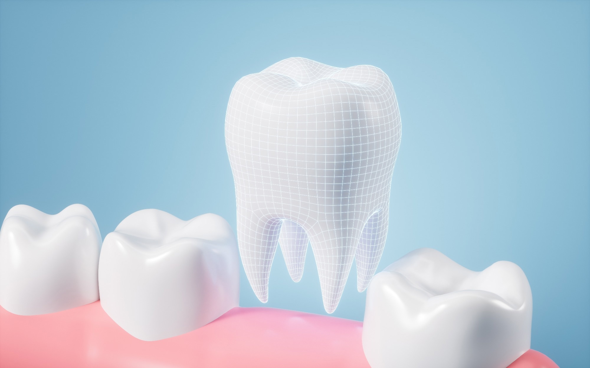 Investigating Cell Adhesion to Orthodontic Mini-Implants Using SEM