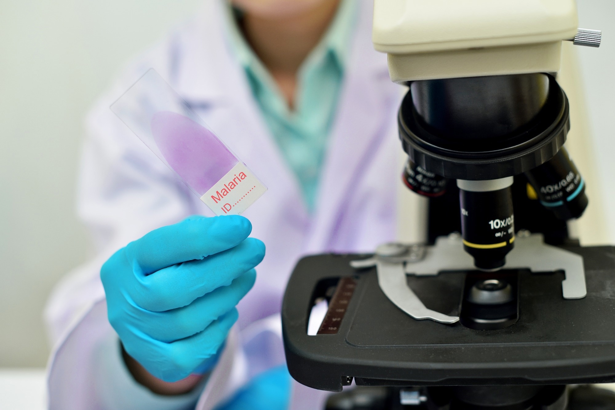 Malaria Detection in Pregnancy: Evaluating RDTs and Microscopy
