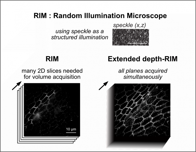 EDF-RIM: A Breakthrough in Imaging Technology