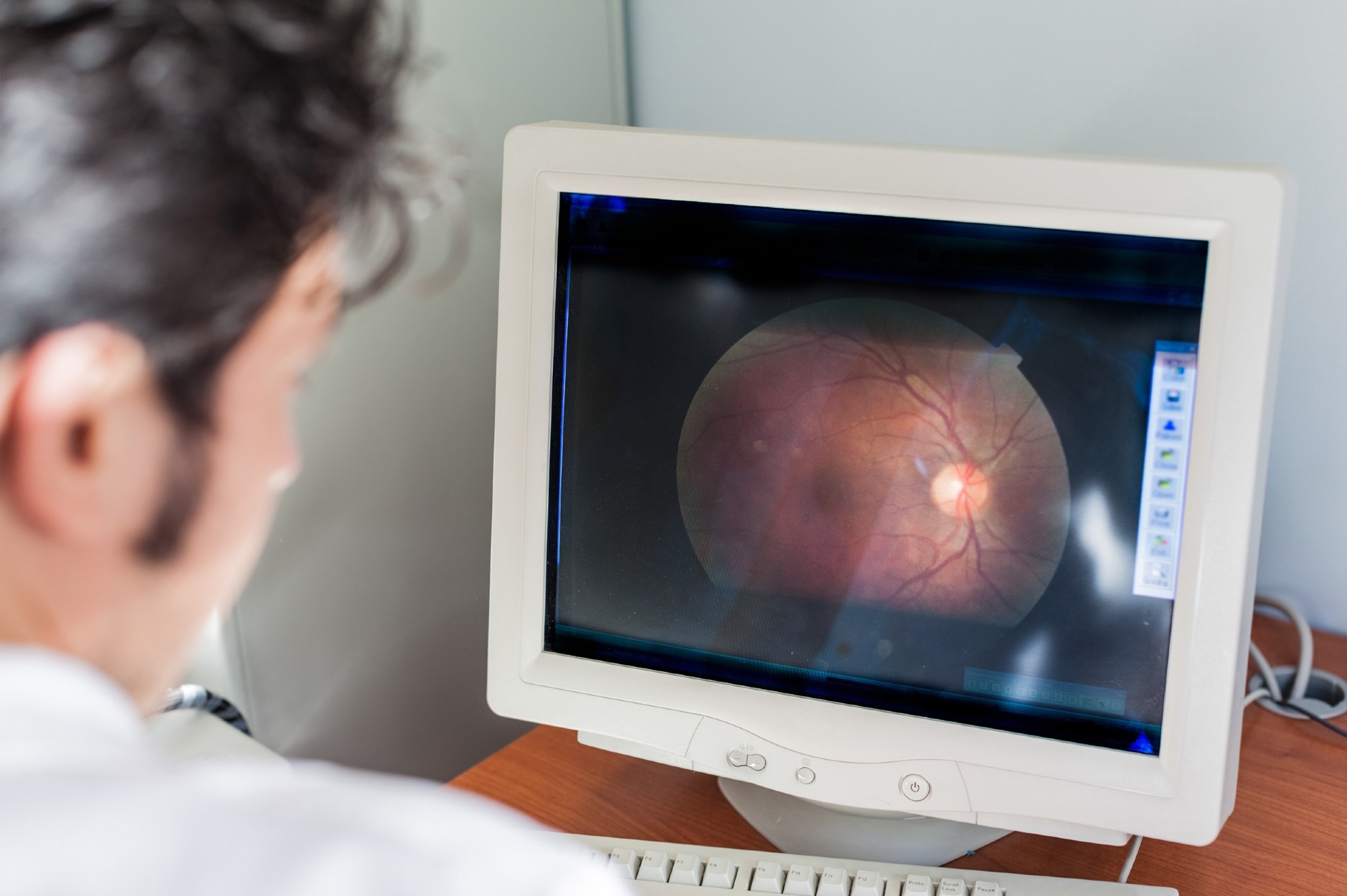 Automated Algorithm for Cone Density Assessment in Retinal Imaging
