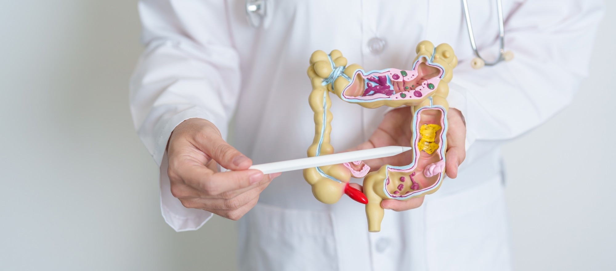 Doctor holding human Colon anatomy model