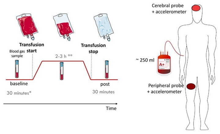 Optimizing Blood Transfusions with Noninvasive Diffuse Optics