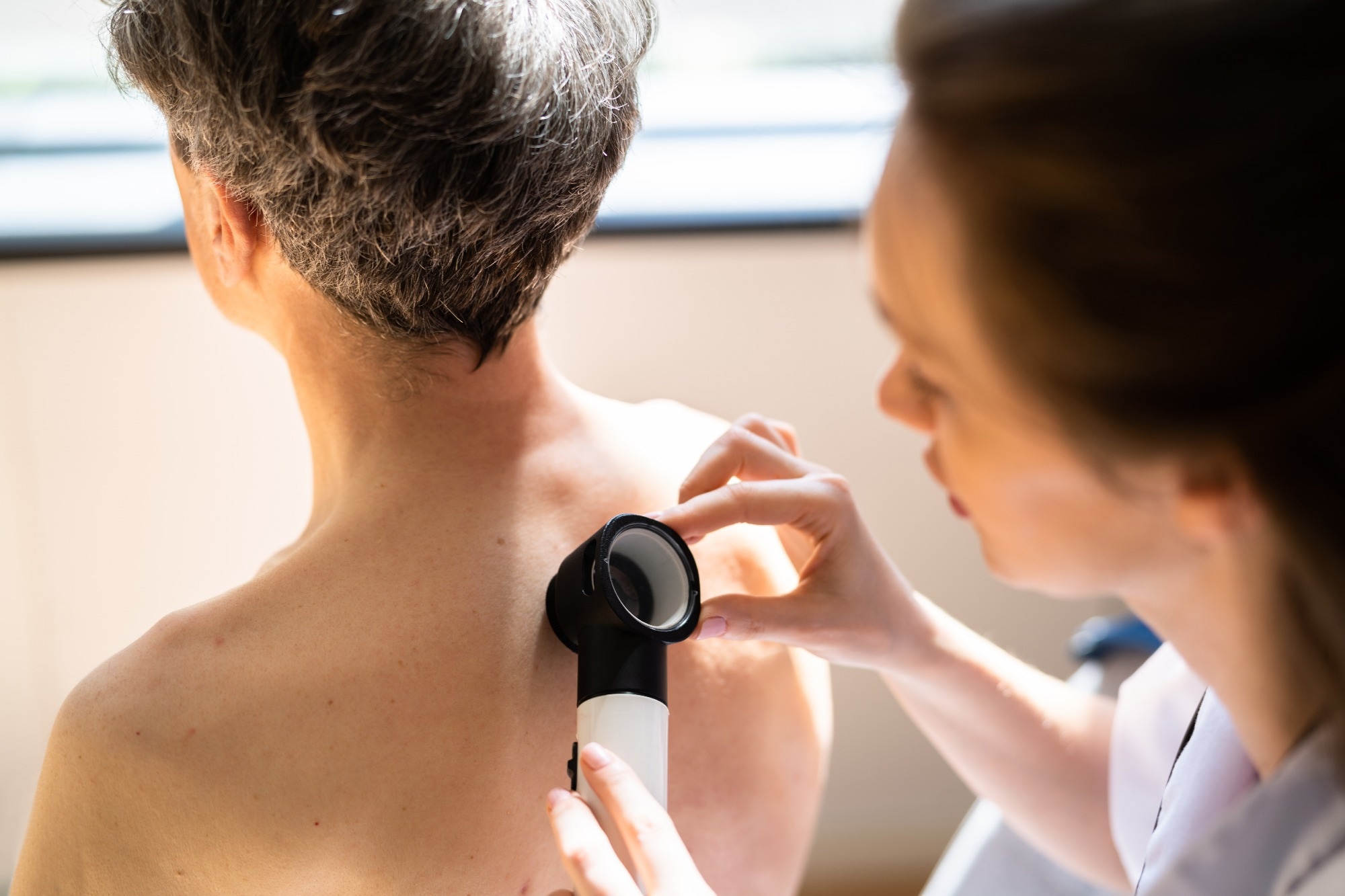 Dermatologist Checking Skin Pigment