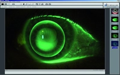 IDS: A Deep Look Into the Eye