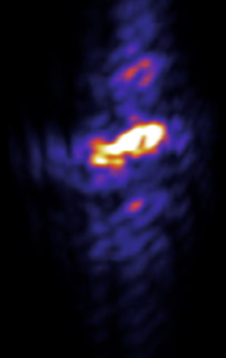 A bright X-ray flash in which Rabi cycling and filamentation were observed.