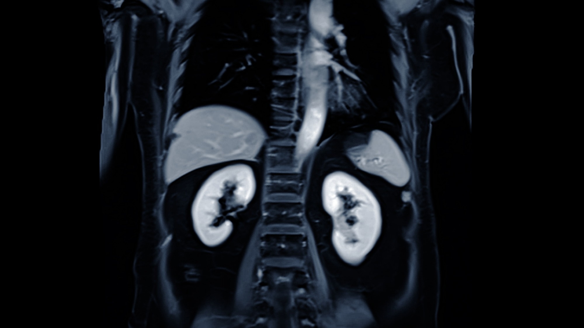 Multiphoton Microscopy Technique Improves Pancreatic Diagnoses