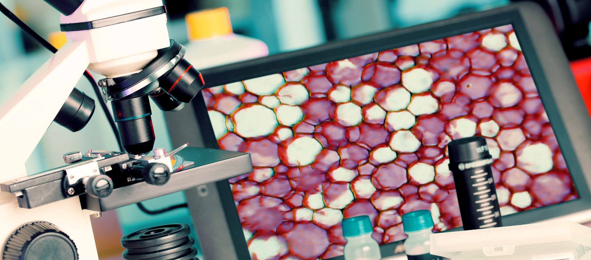 A biopsy test on a microscope