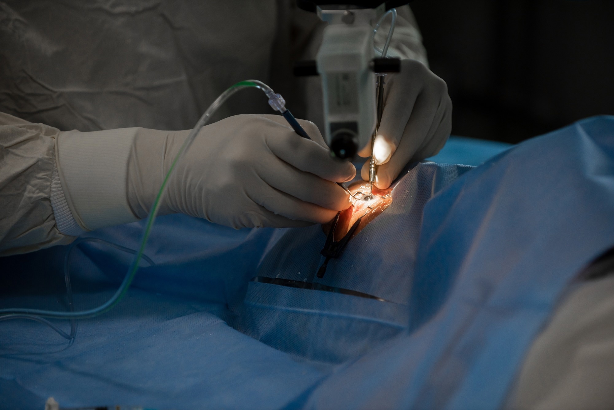 Self-Organizing Laser Beams Accelerate Biomedical Imaging