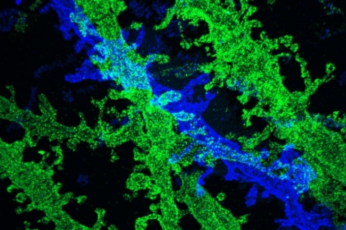 Tissue Expansion Enables Use of Traditional Microscopes for High-Resolution Imaging