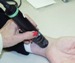 Comprehensive Report on Global Medical Laser Systems Market