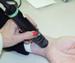 Comprehensive Report on Global Medical Laser Systems