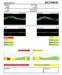 Diopsys CORDA Software Uses SD-OCT Images to Diagnose Vision Disorders
