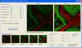 Olmpus Releases New Software for Confocal Laser Scanning Microscope and Multiphoton Excitation Systems