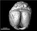 X-ray Computed Tomography Unveils Minute Details of Fossilized Spider
