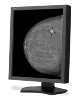 NEC Releases Medical Display for Hospitals