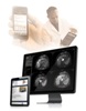 Merge Healthcare Acquires Ophthalmic Imaging Systems for Interoperability Systems