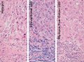 Olympus BX3 Microscope Gets True Colour LED Technology for Histology and Cytology