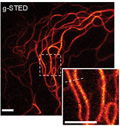 Leica to Develop Next Generation Super-Resolution STED Microscopy