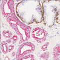 Leica Launch First Automated One-Step Dual Chromogen IHC Detection System for Use With Antibody Cocktails