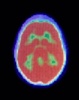 Potential Imaging Agent for Early Diagnosis of Alzheimer’s Disease