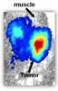 Cerenkov Luminescence Endoscopy Shows Promise in Treating Cancer