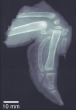 Novel Technique to Sharpen X-Ray Imaging