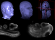 New Open Platform for Improved Biomedical-Image Processing