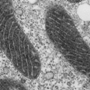 MIT Chemists Design Green Fluorescent Protein Equivalent for Electron Mmicroscopy