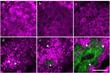 In Vivo Harmonic Generation Microscopy to Detect Chronological Aging Parameters