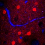 Advanced Brain Imaging Using Three-Photon Microscopy