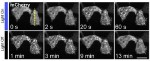 Light and Genetics Used to Manipulate Cells