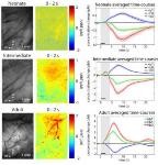 New Optical Imaging Study Helps Understand Infant Brain Development