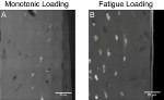 Transmission X-ray Microscopy Uncovers Cellular-Level Detail of Bone Damage