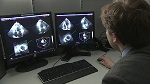 Innovative Software Improves Quality and Field of View of Ultrasound Images